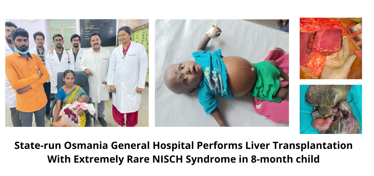 Osmania General Hospital Performs Liver Transplantation With Extremely Rare NISCH Syndrome in 8-month child