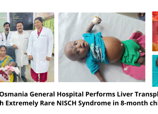 Osmania General Hospital Performs Liver Transplantation With Extremely Rare NISCH Syndrome in 8-month child