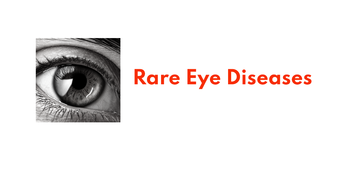 Rare Eye Diseases