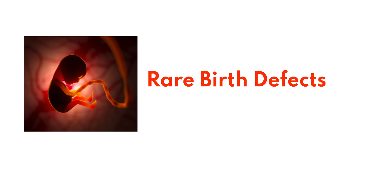 Rare Birth Defects