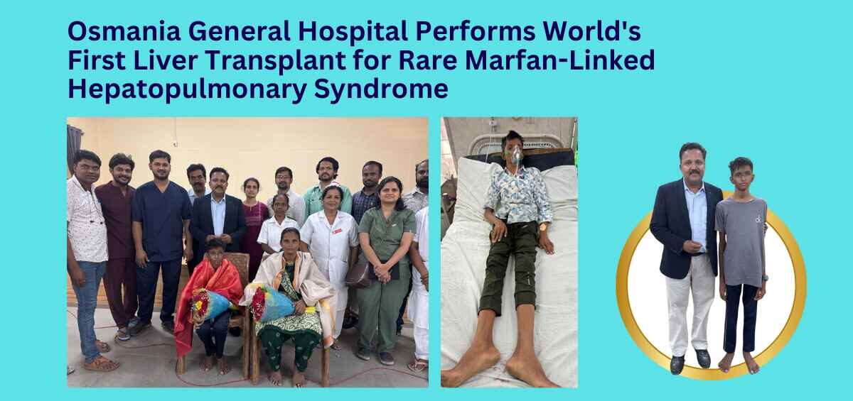 Osmania General Hospital Performs World's First Liver Transplant for Rare Marfan-Linked Hepatopulmonary Syndrome